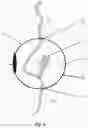 Fig. 07 - Device for Deterring Abuse of Drugs