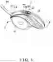 Fig. 02 - Locking mechanism for pet retractor