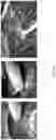 Fig. 16 - Systems and methods for fabricating 3D soft microstructures