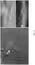 Fig. 17 - Systems and methods for fabricating 3D soft microstructures