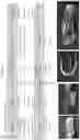 Fig. 18 - Systems and methods for fabricating 3D soft microstructures