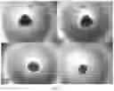 Fig. 14 - Benzothiophene-based selective estrogen receptor downregulators