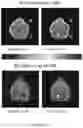 Fig. 15 - Compounds for use as iron(III) MRI contrast agents