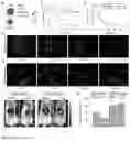 Fig. 05 - Bright monomeric near-infrared fluorescent proteins engineered from bacterial phytochromes and methods for making same