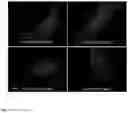 Fig. 14 - Bright monomeric near-infrared fluorescent proteins engineered from bacterial phytochromes and methods for making same