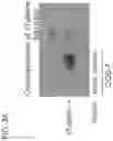 Fig. 07 - Gene therapy for tuberous sclerosis