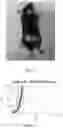 Fig. 16 - METHODS AND COMPOSITIONS FOR TUMOR THERAPY