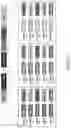Fig. 02 - BCMA chimeric antigen receptors