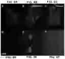 Fig. 09 - CD20 scFv-ELPs methods and therapeutics