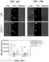 Fig. 16 - CD20 scFv-ELPs methods and therapeutics