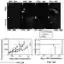 Fig. 18 - CD20 scFv-ELPs methods and therapeutics