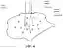 Fig. 16 - On demand radiation induced constructive and deconstructive chemical reactions