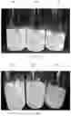 Fig. 03 - Insulation layer composition and insulation layer for plant tissue culture