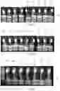 Fig. 06 - Insulation layer composition and insulation layer for plant tissue culture