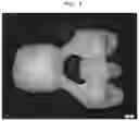 Fig. 10 - Burn-out dental modelling material