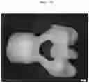 Fig. 11 - Burn-out dental modelling material