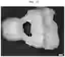 Fig. 13 - Burn-out dental modelling material