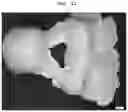 Fig. 14 - Burn-out dental modelling material