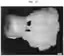 Fig. 16 - Burn-out dental modelling material