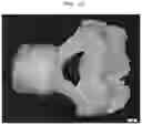 Fig. 17 - Burn-out dental modelling material