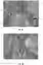 Fig. 04 - MULTI-LAYER CLEANING AND DISINFECTING WIPES HAVING OPTIMAL DELAMINATION BEHAVIOR WITH CLEANING LOTION