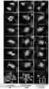 Fig. 02 - METHOD OF REDUCING CHROMOSOME SEGREGATION ERROR IN CELLS OF THE EARLY EMBRYO