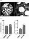 Fig. 04 - METHOD OF REDUCING CHROMOSOME SEGREGATION ERROR IN CELLS OF THE EARLY EMBRYO