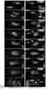 Fig. 06 - METHOD OF REDUCING CHROMOSOME SEGREGATION ERROR IN CELLS OF THE EARLY EMBRYO