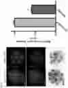 Fig. 09 - METHOD OF REDUCING CHROMOSOME SEGREGATION ERROR IN CELLS OF THE EARLY EMBRYO