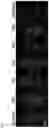 Fig. 11 - METHOD OF REDUCING CHROMOSOME SEGREGATION ERROR IN CELLS OF THE EARLY EMBRYO