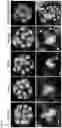 Fig. 16 - METHOD OF REDUCING CHROMOSOME SEGREGATION ERROR IN CELLS OF THE EARLY EMBRYO