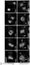 Fig. 18 - METHOD OF REDUCING CHROMOSOME SEGREGATION ERROR IN CELLS OF THE EARLY EMBRYO