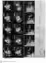 Fig. 20 - METHOD OF REDUCING CHROMOSOME SEGREGATION ERROR IN CELLS OF THE EARLY EMBRYO