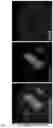 Fig. 25 - METHOD OF REDUCING CHROMOSOME SEGREGATION ERROR IN CELLS OF THE EARLY EMBRYO