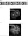 Fig. 29 - METHOD OF REDUCING CHROMOSOME SEGREGATION ERROR IN CELLS OF THE EARLY EMBRYO