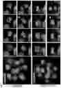 Fig. 37 - METHOD OF REDUCING CHROMOSOME SEGREGATION ERROR IN CELLS OF THE EARLY EMBRYO