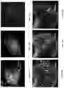 Fig. 31 - Three-dimensional printed organs, devices, and matrices