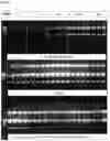 Fig. 04 - METHOD FOR ISOLATING HIGHLY PURE NUCLEIC ACID WITH MAGNETIC PARTICLES