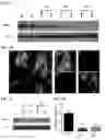 Fig. 04 - Twist signaling inhibitor compositions and methods of using the same