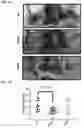 Fig. 06 - Twist signaling inhibitor compositions and methods of using the same
