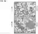 Fig. 12 - Twist signaling inhibitor compositions and methods of using the same