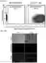 Fig. 16 - Twist signaling inhibitor compositions and methods of using the same