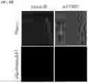 Fig. 24 - Twist signaling inhibitor compositions and methods of using the same