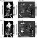 Fig. 32 - Twist signaling inhibitor compositions and methods of using the same