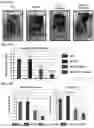 Fig. 35 - Twist signaling inhibitor compositions and methods of using the same