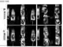 Fig. 50 - Twist signaling inhibitor compositions and methods of using the same