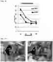 Fig. 51 - Twist signaling inhibitor compositions and methods of using the same