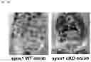 Fig. 09 - Methods for Treating Obesity of a Subject Suffering from Obesity