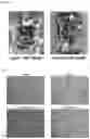 Fig. 11 - Methods for Treating Obesity of a Subject Suffering from Obesity