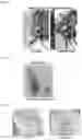 Fig. 14 - Methods for Treating Obesity of a Subject Suffering from Obesity